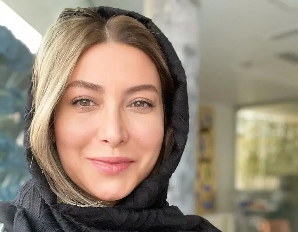 چهره متفاوت فریبا نادری ؛ عمل زیبایی خانم بازیگر!