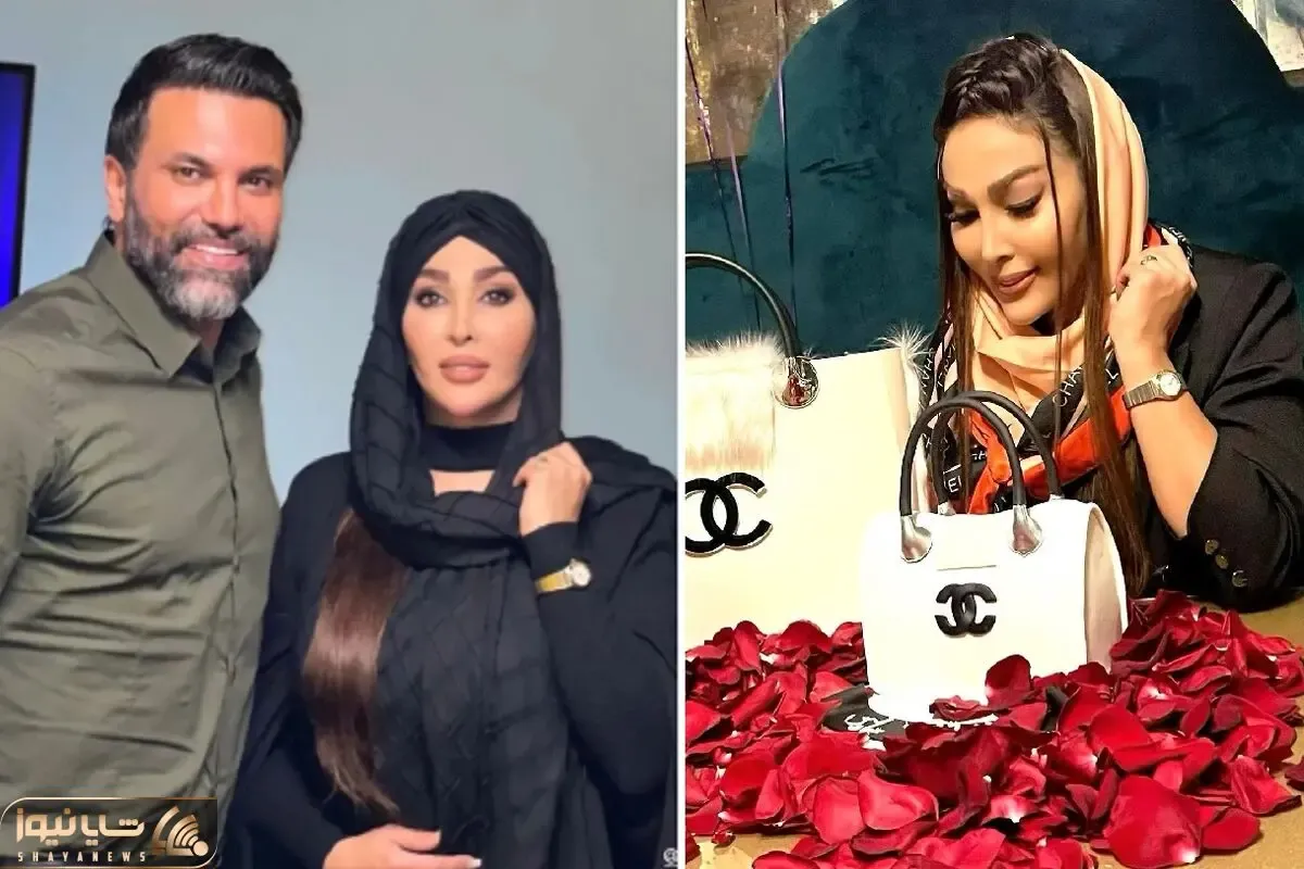 وقتی زنِ علیرضا نیکبخت داخل گونش توپ کار گذاشته جا ژل؛ زرق و برقش چشمو میزنه!