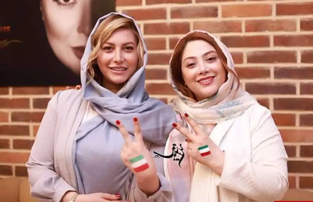 خانم سلبریتی دماغ عملی فقط مانده بود بدنش را برنز کند! +عکس