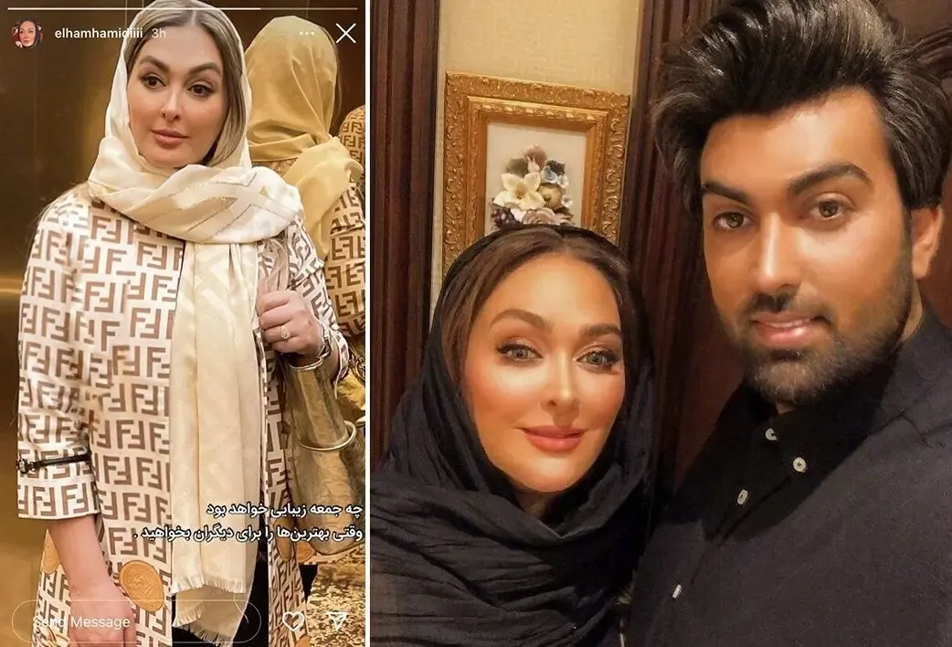 اگه قصد دارید بوتاکس خود را تو چشم همه فرو کنید از 