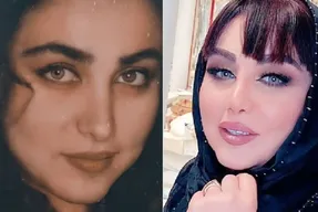 بهنوش بختیاری خوب شد دماغش را عمل کرد! +عکس قبل از عمل