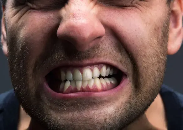 دندان قروچه چیست؟ علت ایجاد و بهترین درمان های خانگی برای آن کدام است؟
