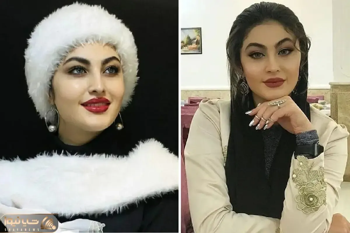 چهره پُر و پِیمون 