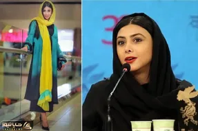 قبل و بعد آزاده صمدی / عمل بینی قبل ازدواج جادو کرد واسش بعد عروسی گرفت زبانزد