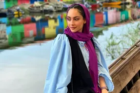 چهره خندان ترلان پروانه که با زاویه فک غیرطبیعی شد!