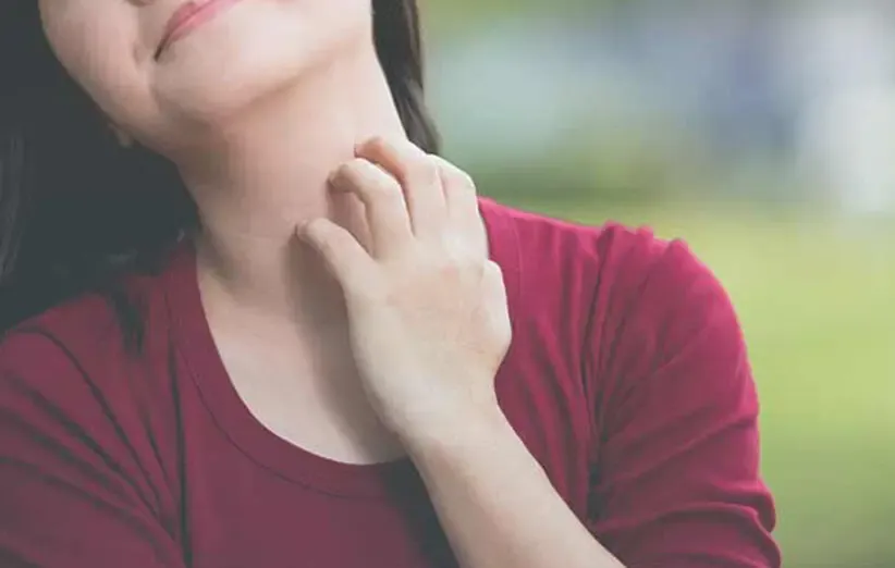 ۹ درمان خانگی برای رهایی از اگزما