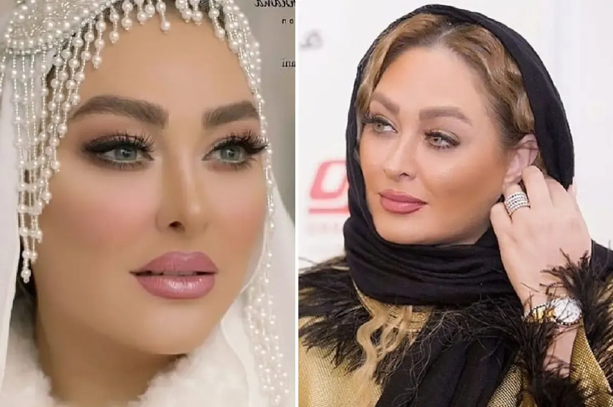عمل بینی 