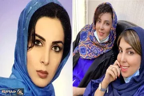 قبل و بعد لیلا بلوکات / نفرتیتی یوسف پیامبر تو بیست سالگی از مدلینگای زمانه اش بود