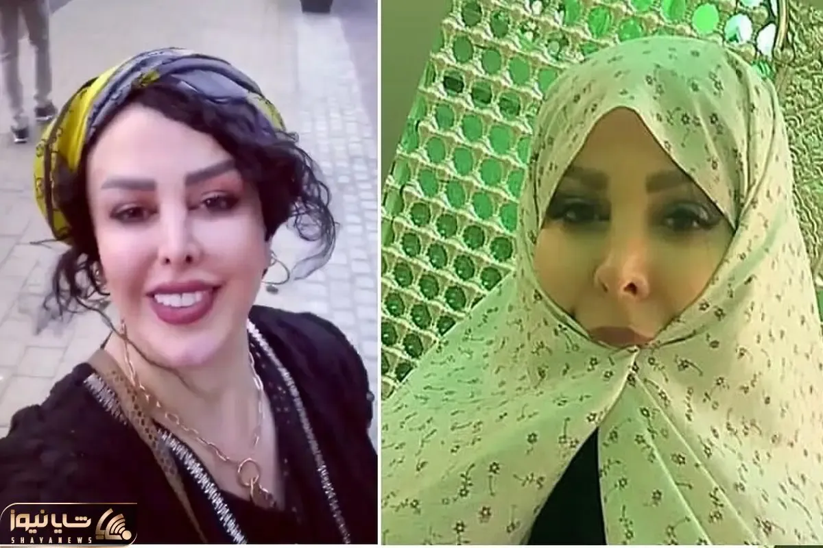فلور نظری دو دقه رفت اونور چه بلبلی آلمانی میحرفه؛ لباش از پروتز الانه که منفجر شه!