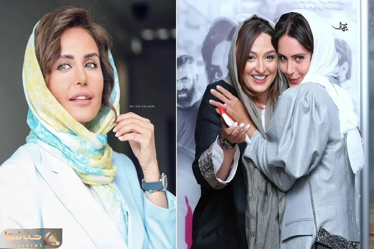 لاغریه استخونی الناز شاکردوست تو این نقشش که واقعا عجیبه؛ حیف نشد اون هالیوودی بودنت؟