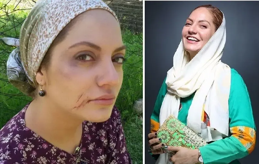 تغیر چهره زیاد