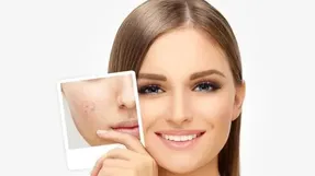 هفت روش طبیعیِ از بین بردنِ جای جوش؛ برای شمایی که پوستی صاف می خواهید