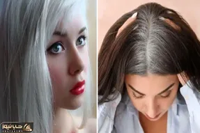 روش های جلوگیری از بیشتر شدن موهای سفید؛ این کارارو با خودت میکنی معلومه مو پیر میشه