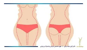 چگونه می‌توانیم بدون رژیم غذایی و ورزش کردن به اندام ایده‌آلمان برسیم؟