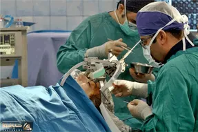 (عکس) خارج کردن تومور ۳.۵ کیلویی از مغز دختر ۱۳ ساله در یزد!