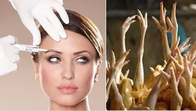 بوتاکس نکنید! به جاش 