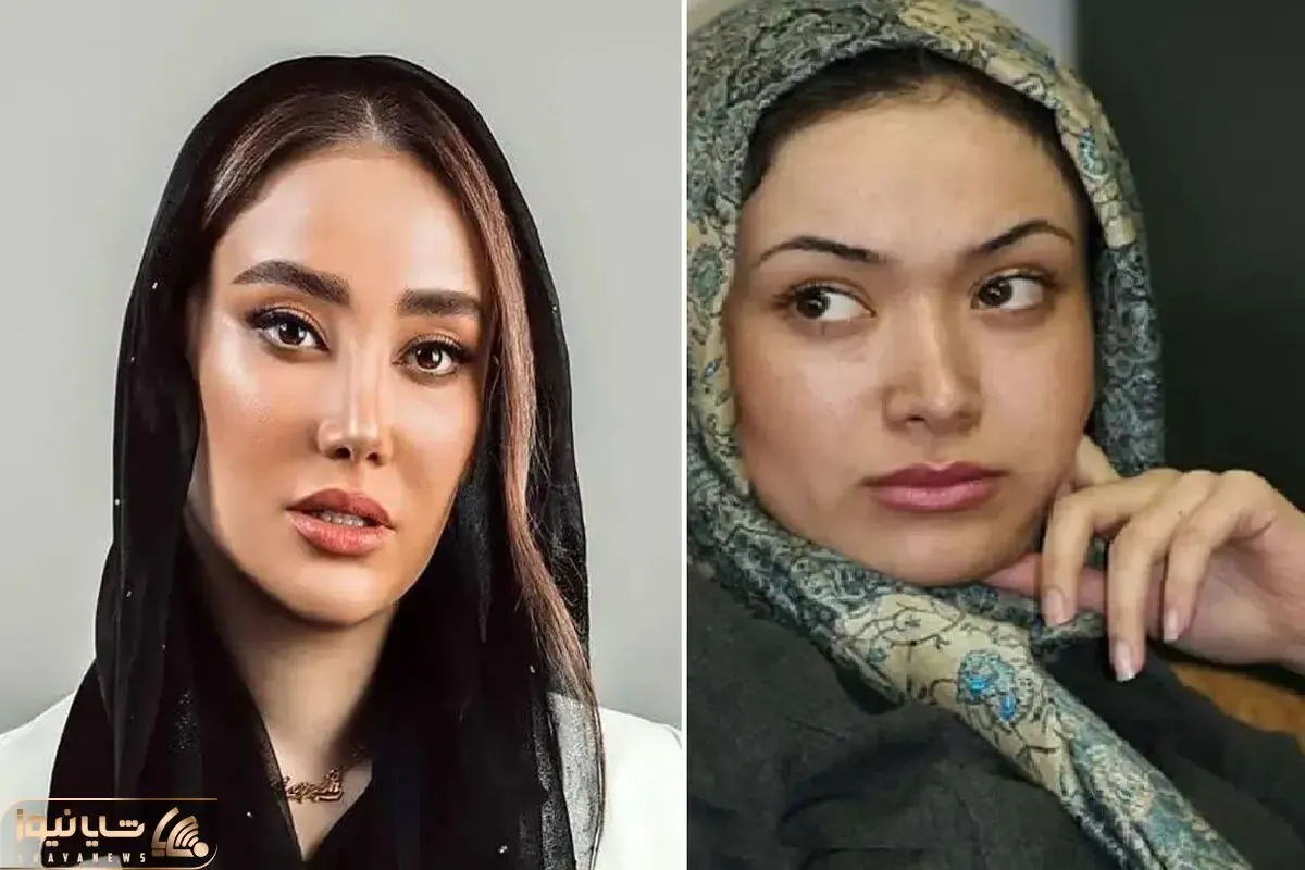 نیو فیس سازی بهاره افشاری بعد از ۱۴ سال/ بیتای فاصله ها یا زنی که دو چهره دارد؟!