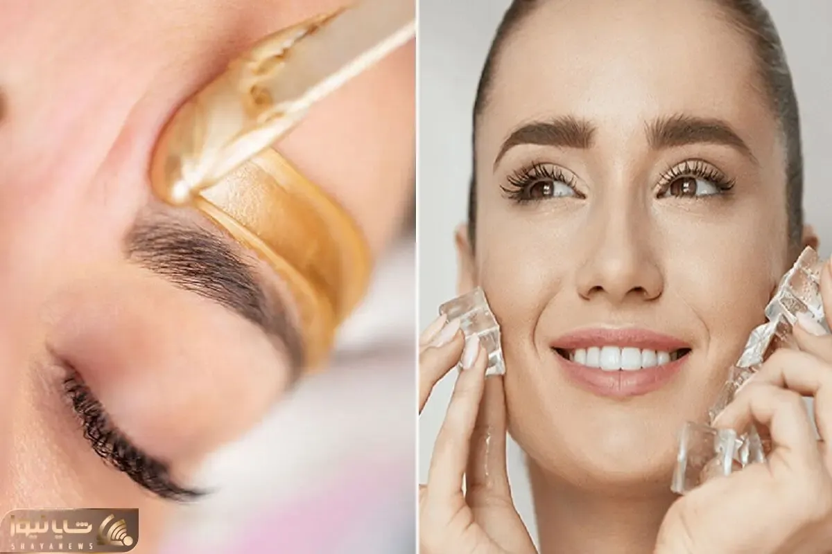 جلوگیری از جوش زدن بعد از اصلاح و وکس با استفاده از قند / قرمزی و سوزش پوستتم میگیره