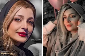 استایل زیادی گرونِ ساره بیات که انگاری طاقه پارچه رو درسته پوشیده؛ ژل تزریقید یا توپ!