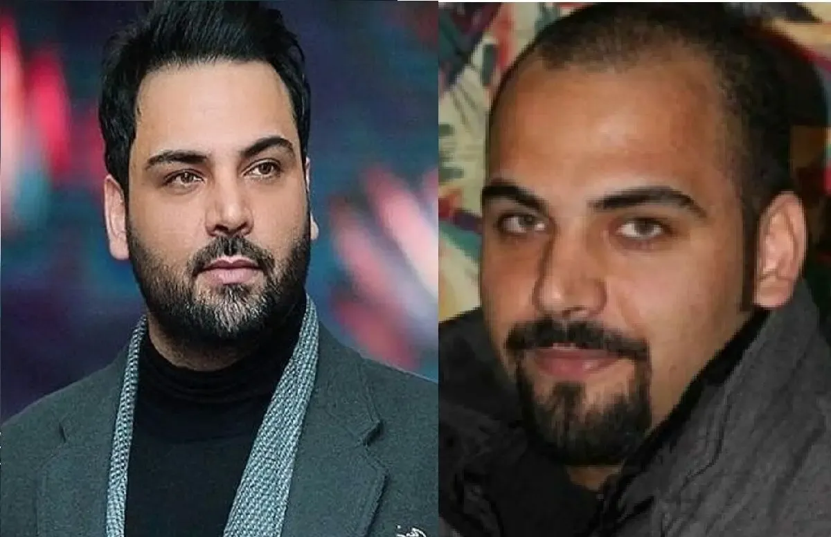 عکس های لو رفته از احسان علیخانی قبل عمل بینی و زمان کچلی!