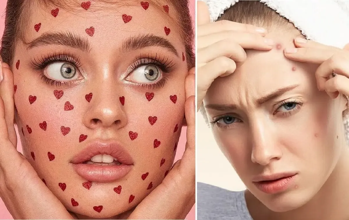خوشگل خانوم فقط تیپت مهم نباشه پوستتم دریاااب؛ اینارو به صورتت نزن تا جوش نزنی!