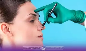 عمل بینی برای چه کسانی خطرناک است؟