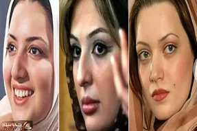 کدوم بازیگر خوشگلترین عمل بینی رو داشته؟/ همراه با معرفی دکتراشون که کارشون حرف نداره