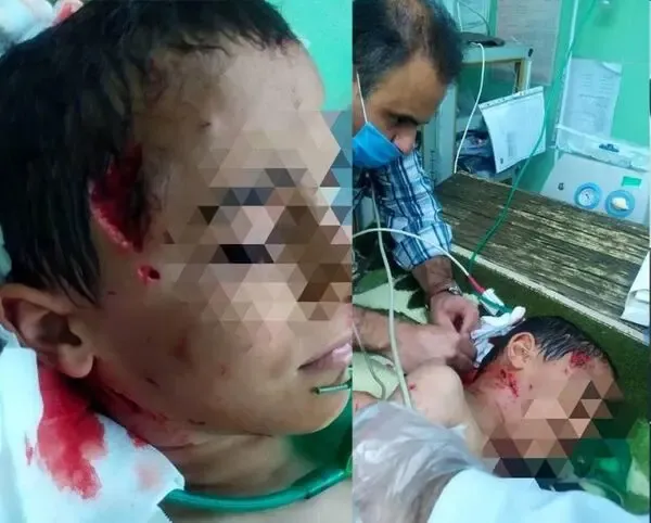 جزییات دریده شدن پسربچه سردشتی توسط سگ های ولگرد+ 16+ فیلم گفتگو و عکس های دلخراش
