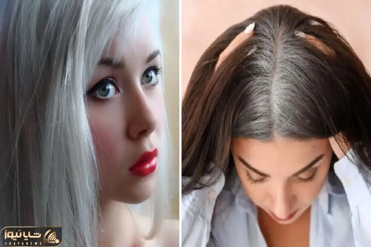 روش های جلوگیری از بیشتر شدن موهای سفید؛ این کارارو با خودت میکنی معلومه مو پیر میشه