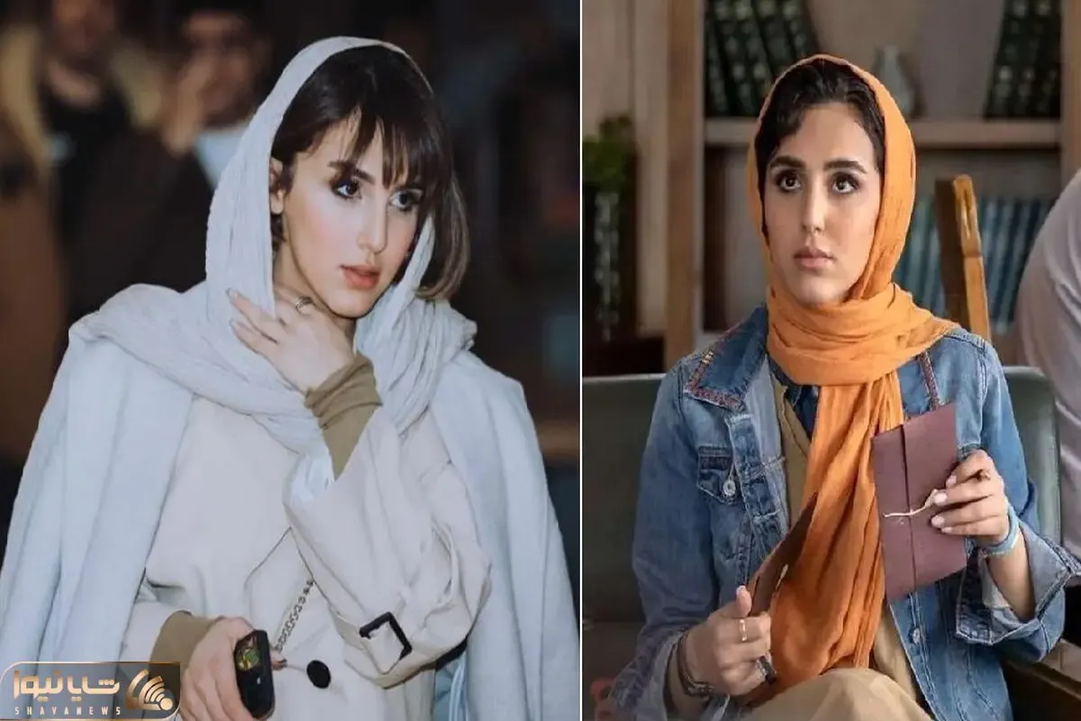 تصاویر تغییر چهره نگار نیکدل بعد زخم کاری / استایل مدل یافته افتر از شهرت