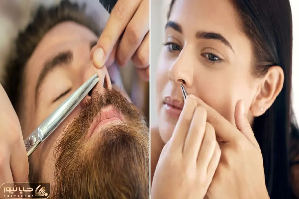 از بین بردن موهای رو و داخل بینی به صورت دائمی / بدون نیاز به لیزر فقط با جوش شیرین