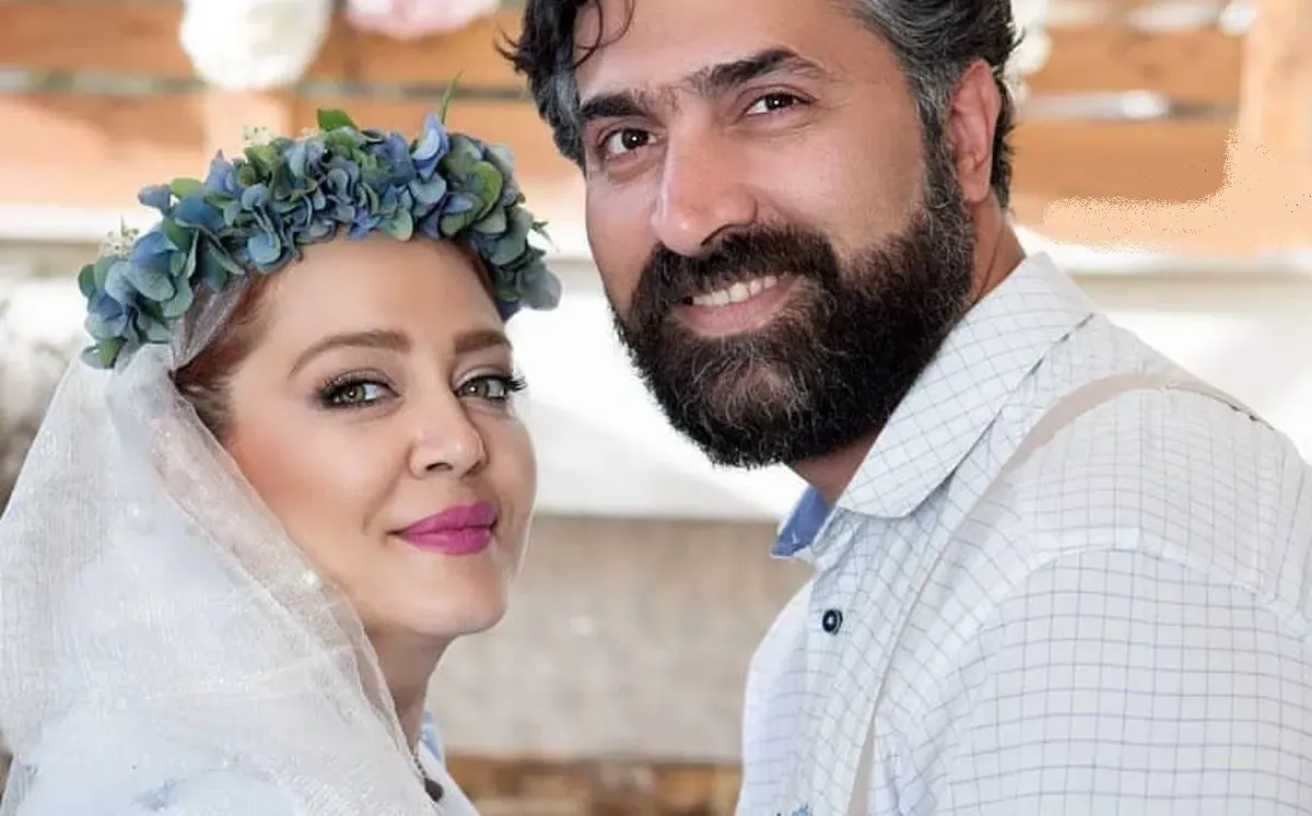 عمل زیبایی بهاره رهنما ؛ بوتاکس کردم! + ویدیو