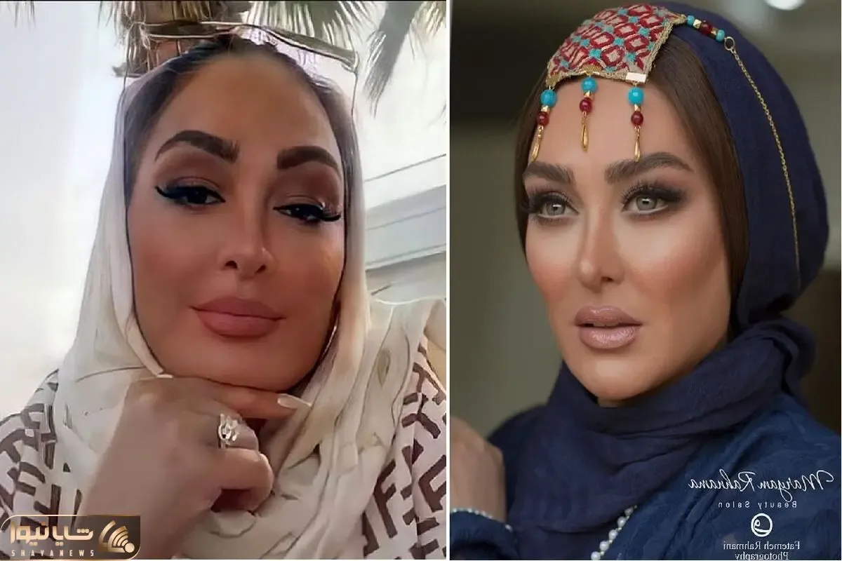 الهام حمیدی با مانتو جواهر دوزش چه شیک شده؛ خانم با این فیس شده سلطان بوتاکس!