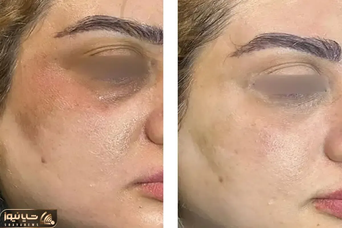 چگونه پوستی روشن تر و شفاف تر داشته باشیم؟ معرفی بهترین محصولات مراقبت از پوست