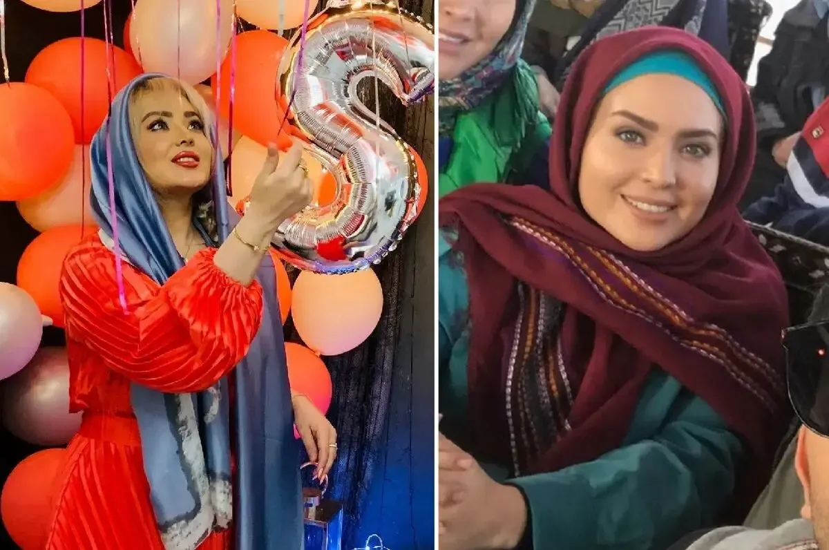 چهره پُررر پروتز 