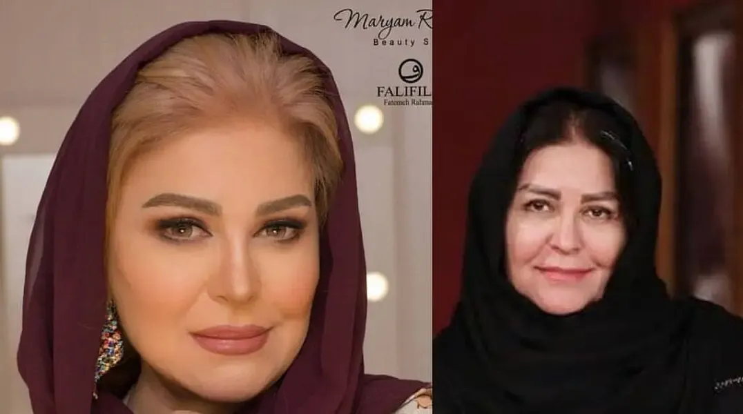 بازیگر میانسال 20 سال جوان و جذاب شد! +عکس
