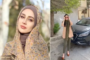 قبل و بعد میترا رفیع / گلنارِ گیلدخت از بیست و پنج سالگی چقدر فیسش پخته شد و آس