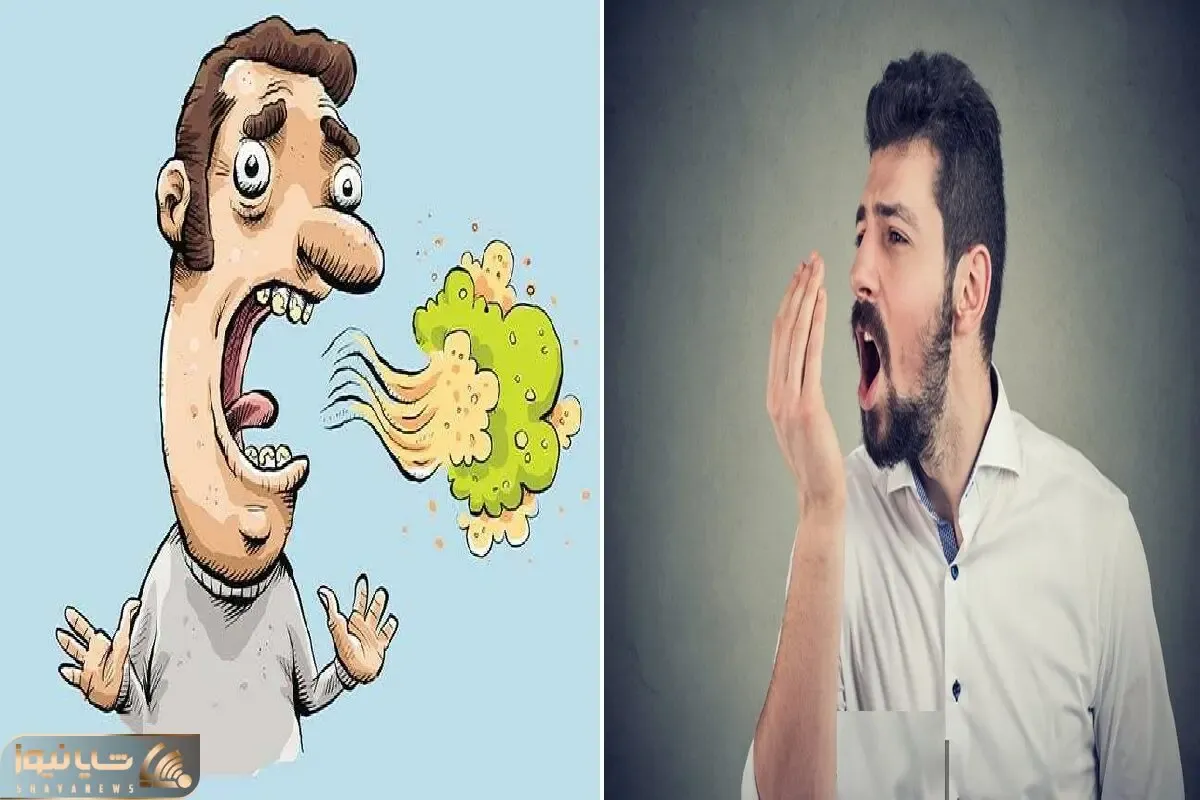 نمیدونی دلیل بوی بد دهن چیه و چطور میشه از شرش خلاص شد؟ با این ترفندا نفست بوی گل میده