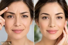 راز پوست شفاف کره ای؛ چطور بدون فیلر پیشانی و خط خنده ای صاف داشته باشیم؟
